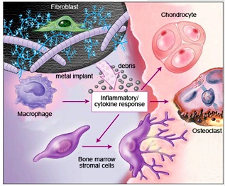 Inflammation