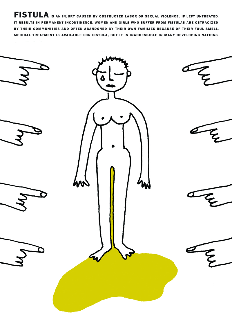 "Fistula" by Joe Scorsone & Alice Drueding 