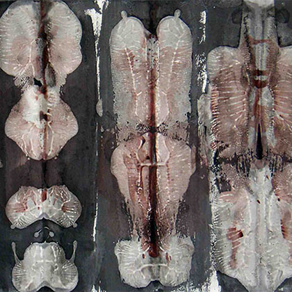 acrylic and ink on paper illustration of the human x-ray of lungs