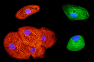 cardiomyocytes